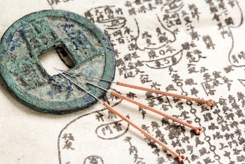中国鍼の秘密：古代から現代への治療法の進化 | 中国語勉強の教材